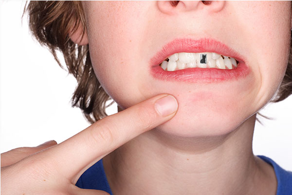 Social mode: TOOTH ART